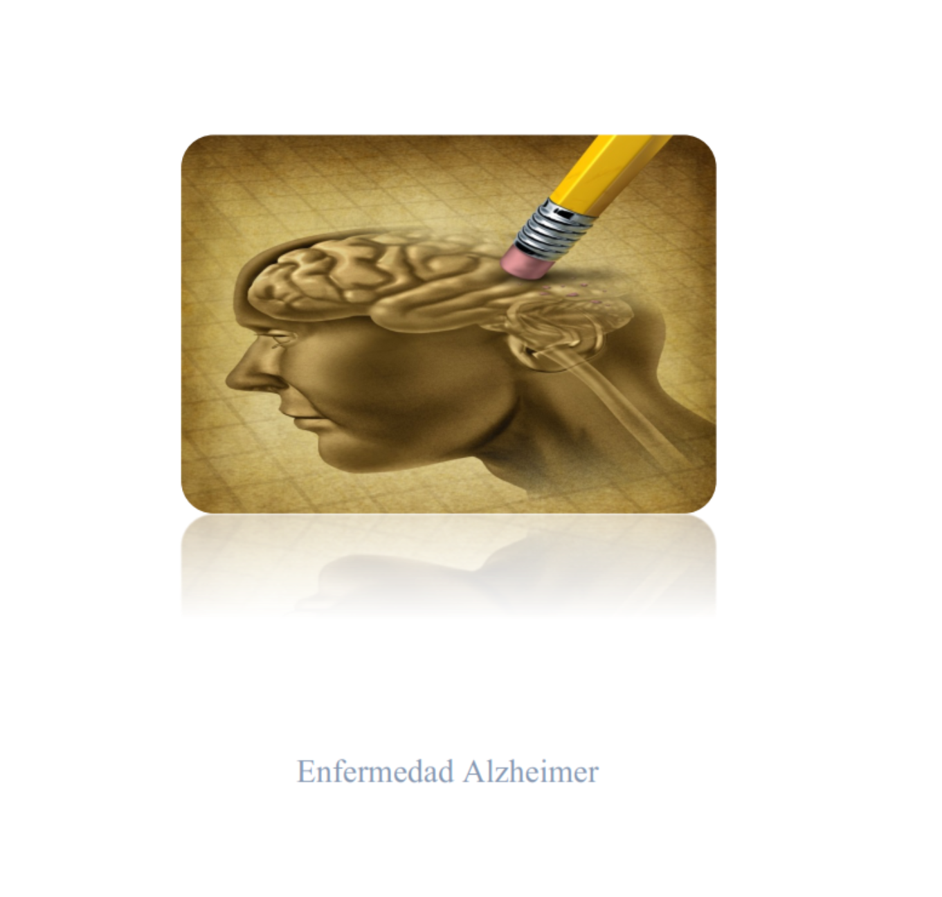 Módulo de Enfermedad Alzheimer